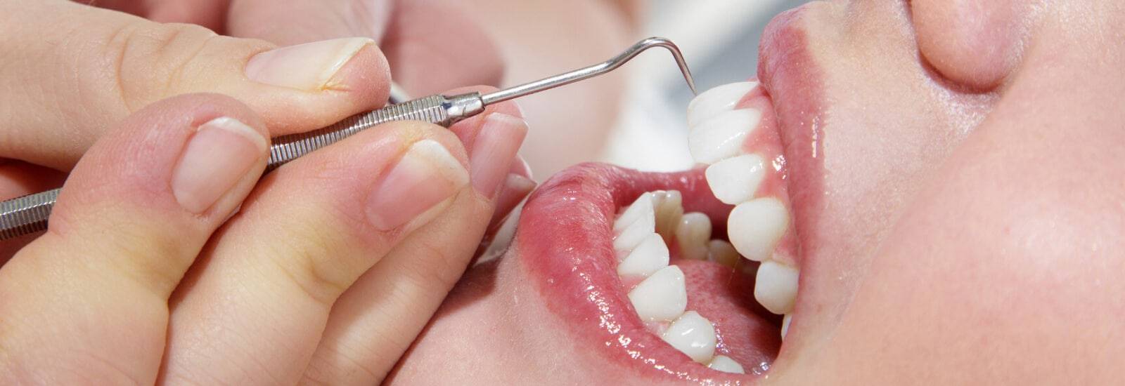Best Dentist Near Sarjapur Road Bangalore