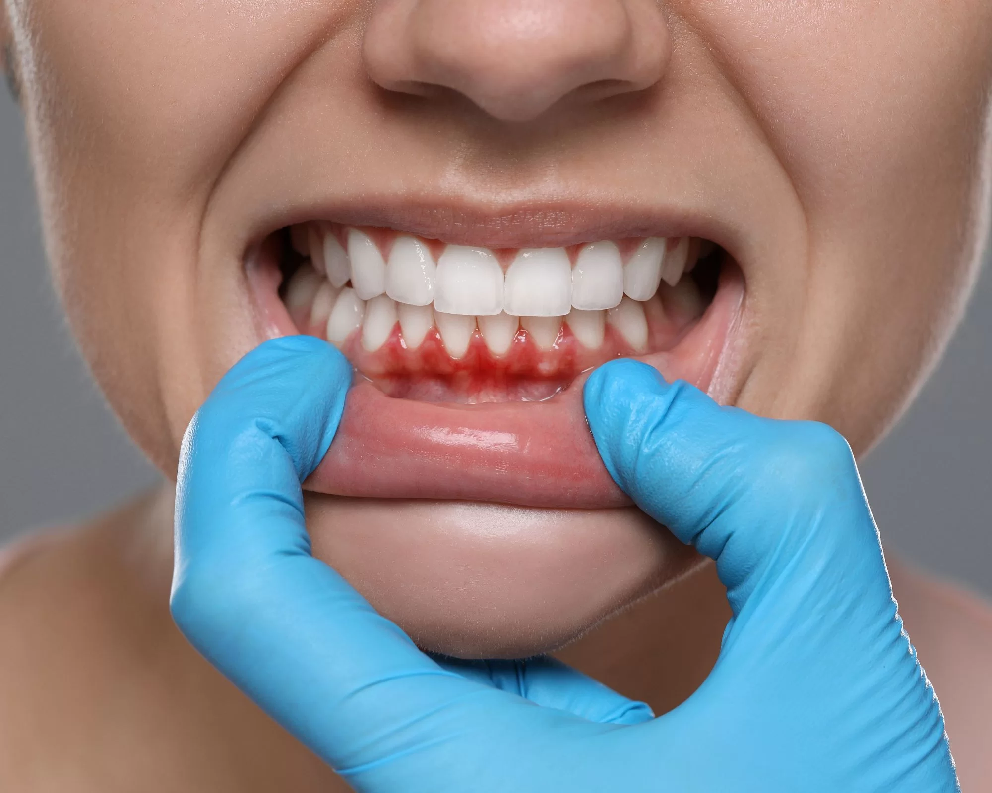 Top dental clinic in Sarjapur Road Bangalore