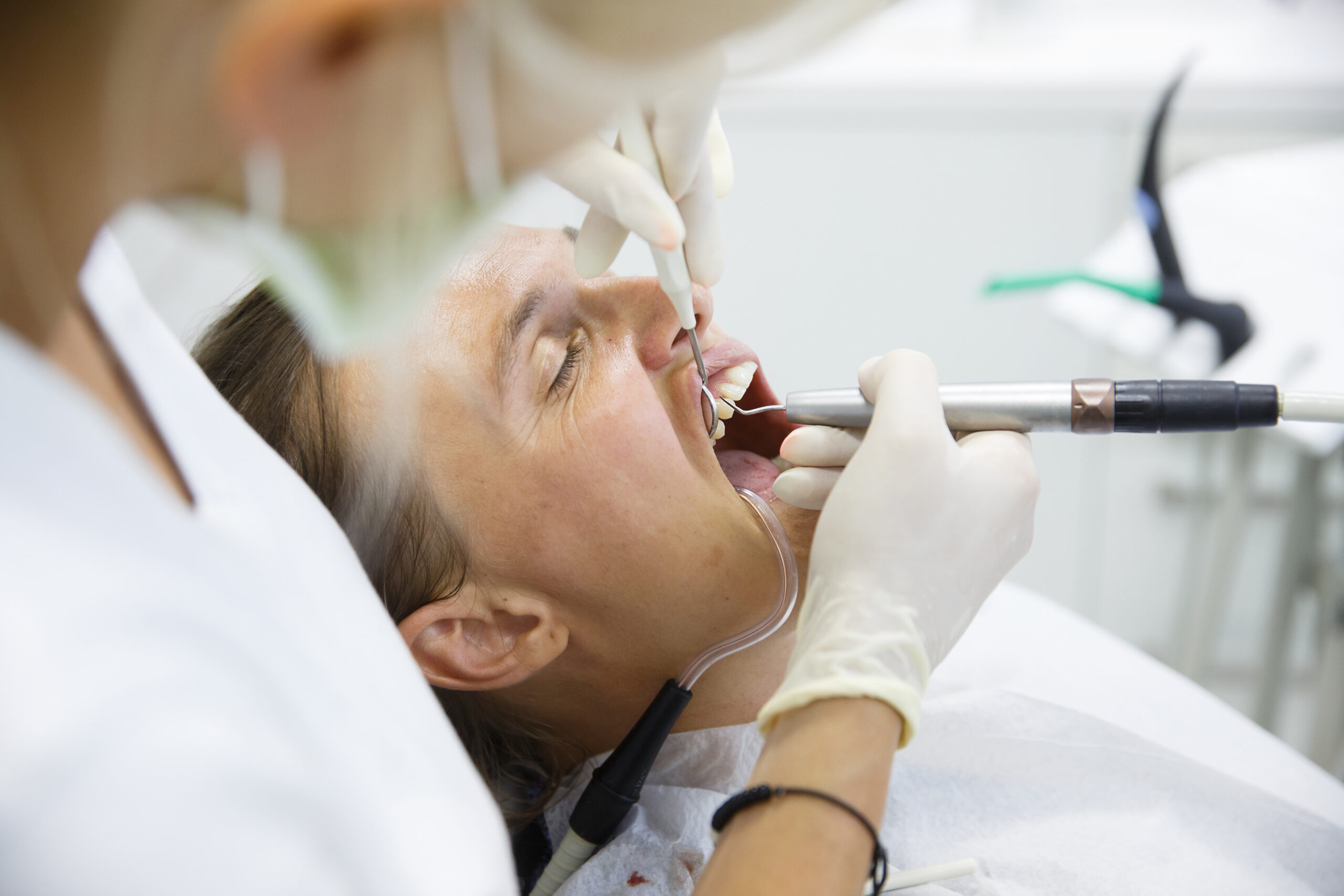Root canal treatment price Bangalore South East