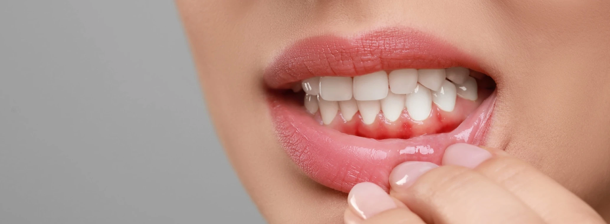 Gum treatment clinic Devarabisanahalli Bangalore