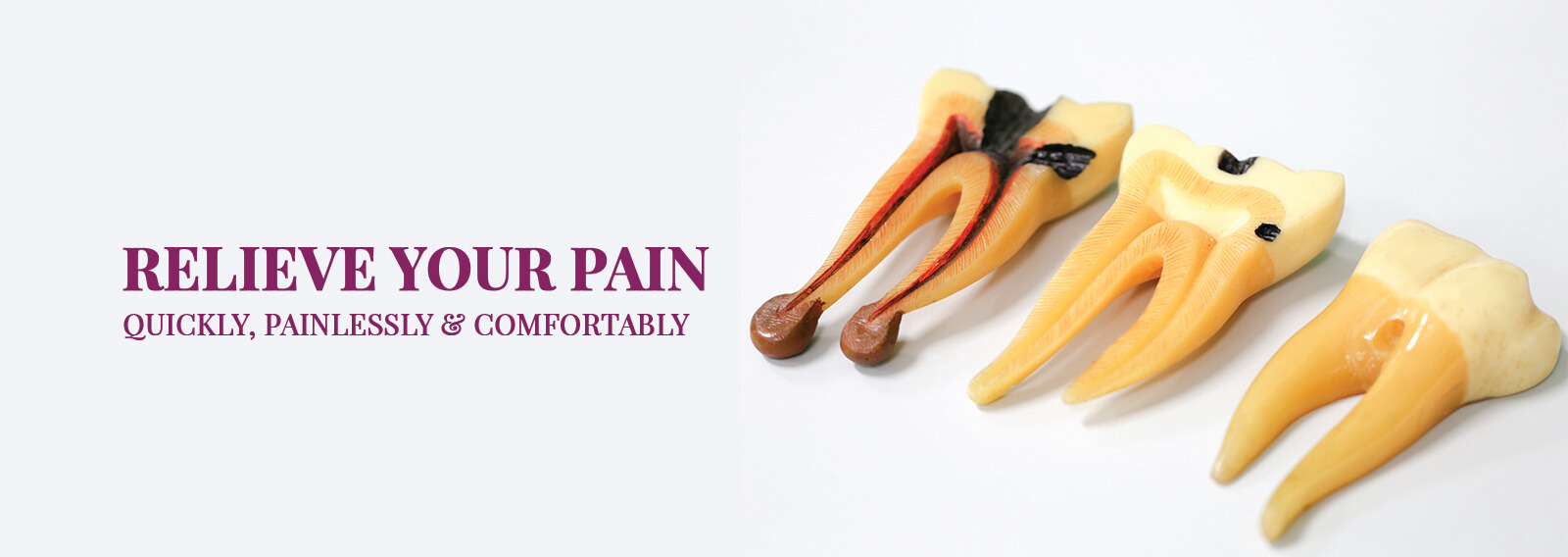 Painless root canal treatment in Bellandur Bangalore