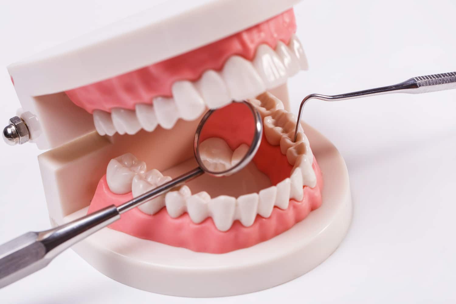Teeth whitening cost Sarjapur Road Bangalore